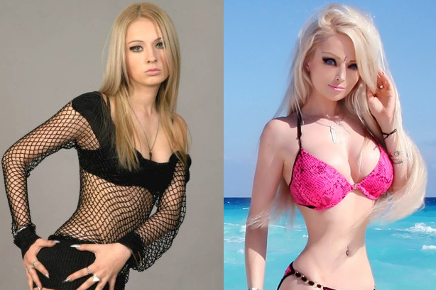 фото до и после пластики Валерия Лукьянова